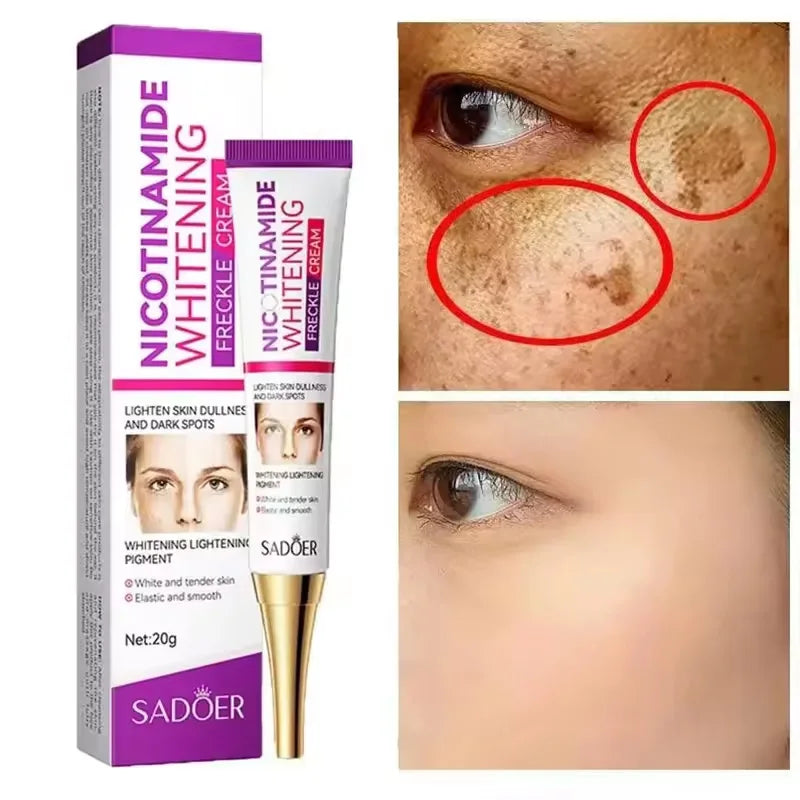 Freckle Removing Cream